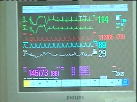 2 Metro Children Sick With H1N1