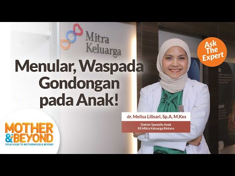 Ask the Expert: Menular, Waspada Gondongan pada Anak!