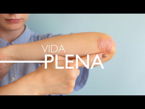 Psoriasis: what it is, symptoms, and how to treat it.