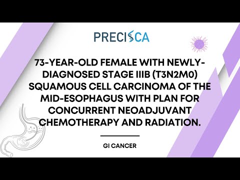 Expert Cancer Panel: Stage IIIB SCC of the mid-esophagus w/ plan for concurrent NAC and radiation