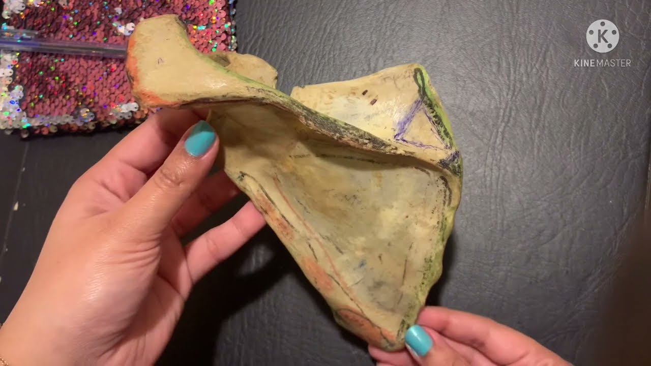 Introduction to Scapula | Side Determination | Intro on Bony features of Scapula | Part 1