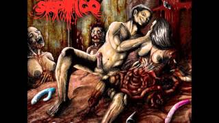 Pro Septico - Refuse Resist (Sepultura)