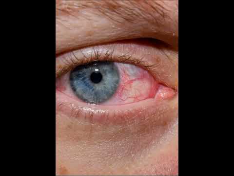 Ayurvedic eye medicine neelkanth eye12, packaging type: box