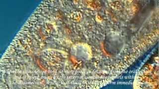How a Paramecium Eats!