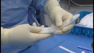 Troubles de l'érection : la pose d'une prothèse pénienne - Allô Docteurs