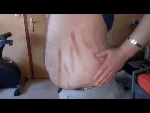 Die Behandlung Dehnung der Nackenmuskulatur im Kind Schmerzen hinter dem unteren Rücken