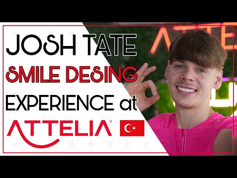 @joshtatemusic  HAS HIS TEETH DONE IN TURKEY