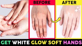 ✋Best Remedy Get White Glow Soft and Smooth Hands, Fix Wrinkled & Dry hands, Beautiful fingers