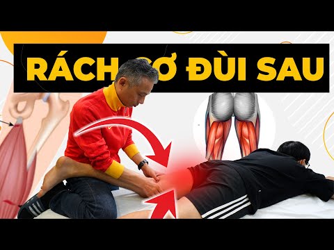 SỐC: Rách Cơ Đùi Sau - THẢM HỌA Tiềm Ẩn Khiến Bạn TÀN PHẾ Nếu Điều Trị Sai