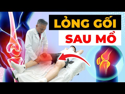 LỎNG GỐI SAU PHẪU THUẬT: Nỗi Ám Ảnh Khiến Bạn Mất Ngủ Mỗi Đêm