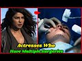 Bollywood Actresses Who Got Multiple Surgeries Priyanka Chopra Katrina Kaif Alia Bhatt Shilpa
