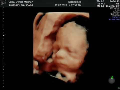 5D Enzo Fabrizio SCOPPA Sem29