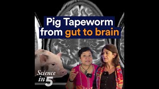 Science in 5, Episode 145 - PIG TAPEWORM