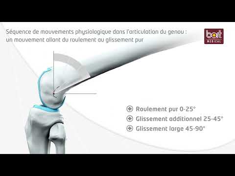 Une orthétique du genou innovante : Articulation courbée polaire BORT