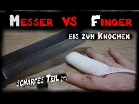 Messer VS Finger ....bis auf den Knochen -