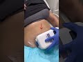How To Freeze Your Fat With CoolSculpting Dr Swati Kannan Shorts