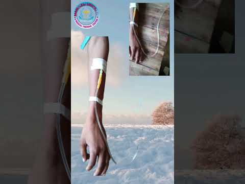 IV injection injected vein#short #viral #gda