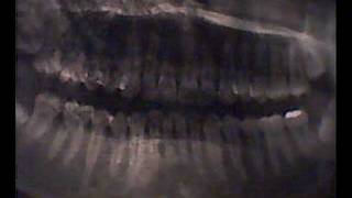 hendrix necro  Sonic Youth - dirty deluxe edition