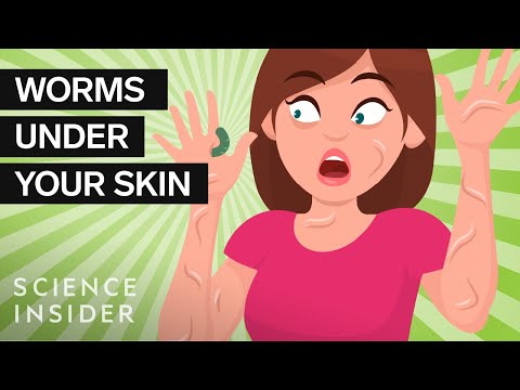 那些在你身上下蛋的蟲子 (The Bugs That Lay Eggs All Over Your Body)