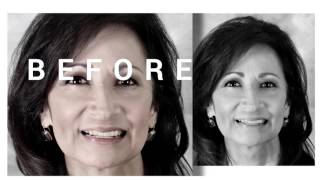 Professional Teeth Whitening in Pasadena: A New Smile