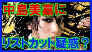 中島美嘉が徹子の部屋で手首に傷が・・・あったのか？疑惑が！！