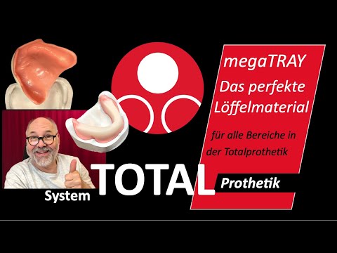 Das perfekte Löffelmaterial - megaTRAY - Autopolymerisat - #KallemachtProthesen -