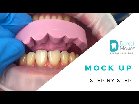 Mock up - Step by step. 🦷💡