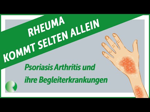 📢Rheumatism rarely comes alone: ​​Psoriatic arthritis and its accompanying diseases