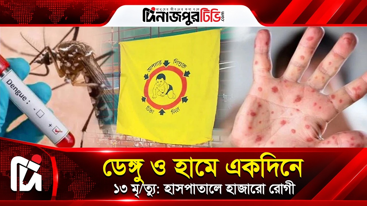  ডেঙ্গু ও হামে একদিনে ১৩ মৃ/ত্যু: হাসপাতালে হাজারো রোগী | Dinajpur TV | News