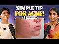 Simple Tip For Acne Dr Manisha On Body To Being Shlloka