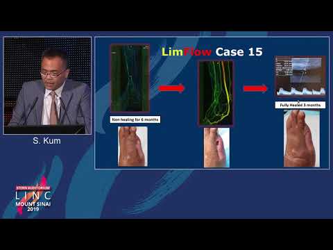 Stern D2 - LIM: Flow in Desert Foot - Dr. Steven Kum