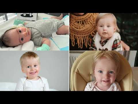 Growth Hormone Therapy in PWS | Dr. Namrata Upadhya | Pediatric Endocrinology | Aster Bangalore