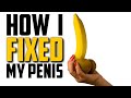 Pro Comeback - Day 42 - How I Fixed My Penis