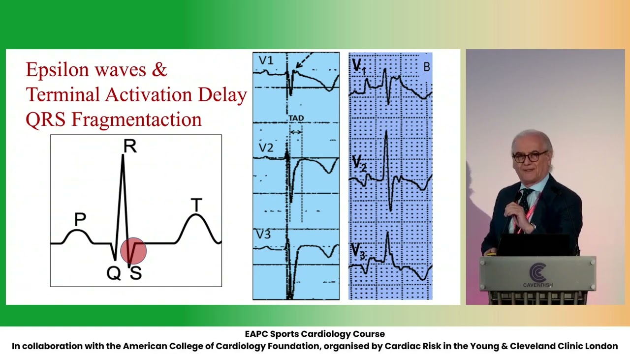 It is all in the depolarisation - D Corrado