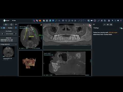 DCMCloud - Dentistry - Findings and Annotate