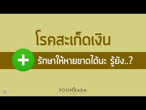 รอยโรคสะเก็ดเงินด้วยแผ่นเล็บ โรคสะเก็ดเงินป่วยหลายวิธี