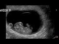 Healthy Pregnancy Fertilization Ruqyah Black Magic Ruqyah Shariah