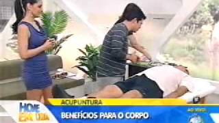ACUPUNTURA CURITIBA - BENEFÍCIOS DA ACUPUNTURA