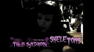 &quot;The Wednesday 13 Syndrome&quot; Episode 3 - Skeletons