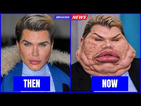 35 Stars Who Completely Ruined Their Faces With Plastic Surgery Disasters | Then and Now Photos 2026