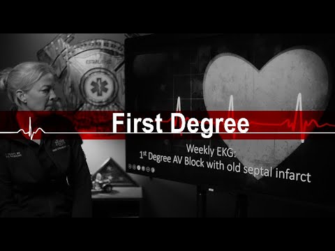 First Degree AV Block: Deceptive EKG from the field