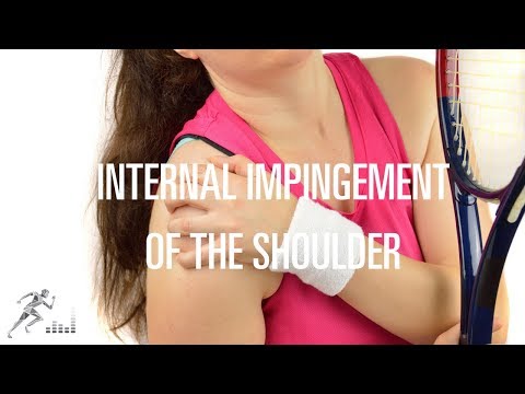 Internal impingement of the shoulder