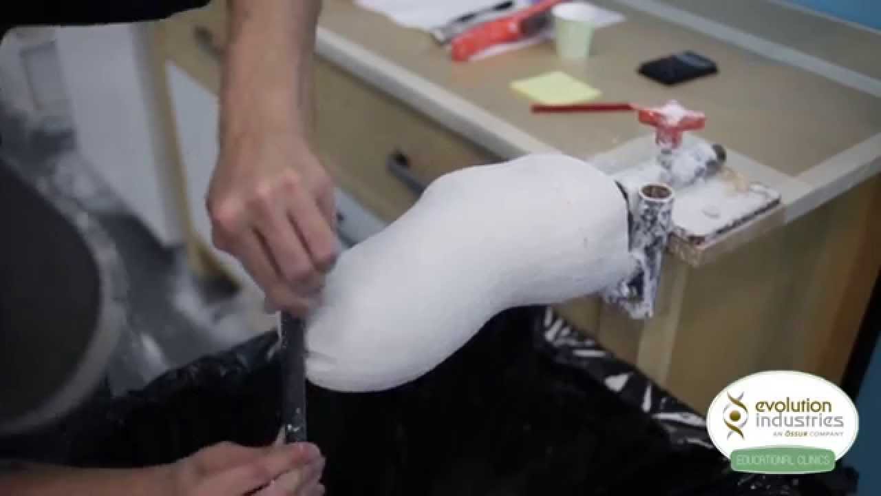 Plaster Cast Modification Demo