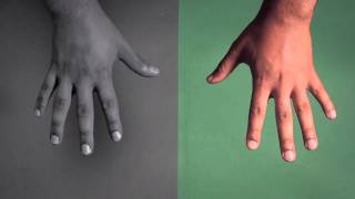 DELS 'Trumpalump' - Official video