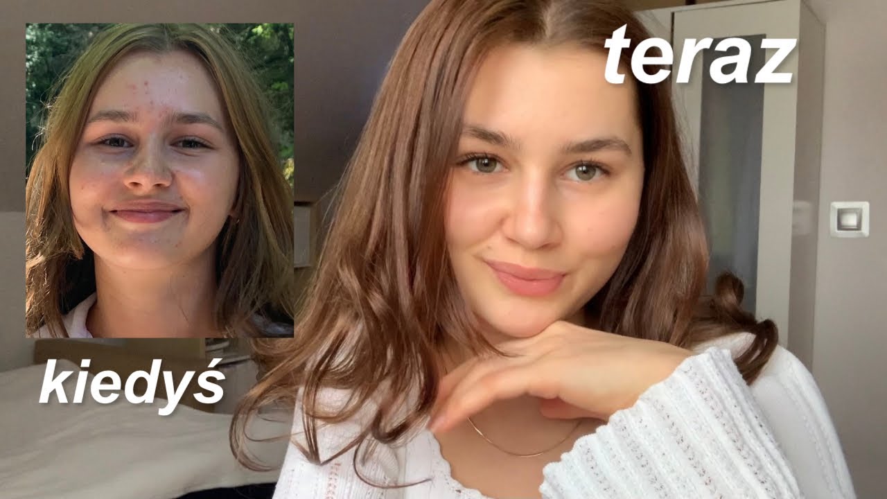 JAK W 2 TYGODNIE OGARNĘŁAM CERĘ (moja pielęgnacja)