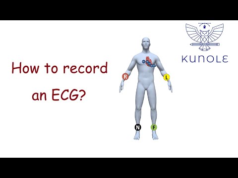 ECG basics (1.1). How to record an ECG?