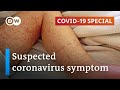 Coronavirus Suspected Of Causing Rare Childhood Disease COVID 19 Special