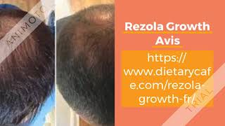 Rezola Growth :- Astuces réussies à la croissance des cheveux!