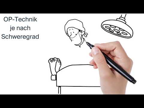 Behandlung eines Hallux Rigidus (by ATOS Kliniken)