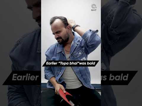 Youtuber Nadeem Bunny (Topa Bhai)  Eight Months Hair Transplant Result #shorts#hairtransplant
